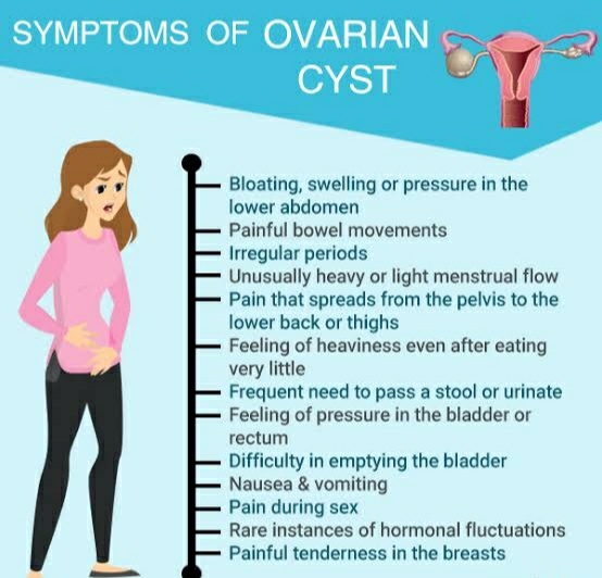 Ovarian Cysts – Dr.meenakshi Singh